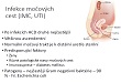 2. UTI, urolithiasis