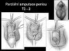 3. Urooncology, retroperitoneum