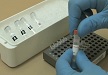 Detekce cirkulujících nádorových buněk (CTCs) v periferní krvi - PCR, elektroforéza a vyhodnocení