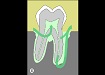 Diagnostika nemocí zubní dřeně a periodoncia