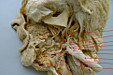Hluboké prostory hlavy Fossa pterygopalatina. Přehled struktur a fotografický atlas preparátů