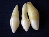 Vývojové a získané poruchy zubů a tvrdých zubních tkání